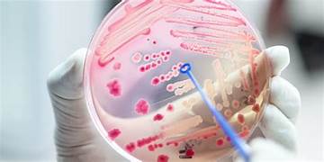 Antibiotic resistance is at a crisis point