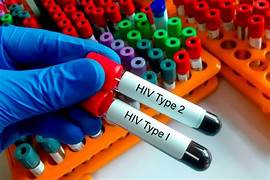 HIV today: a changed landscape